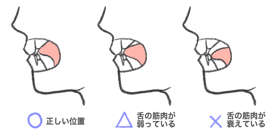 イラスト